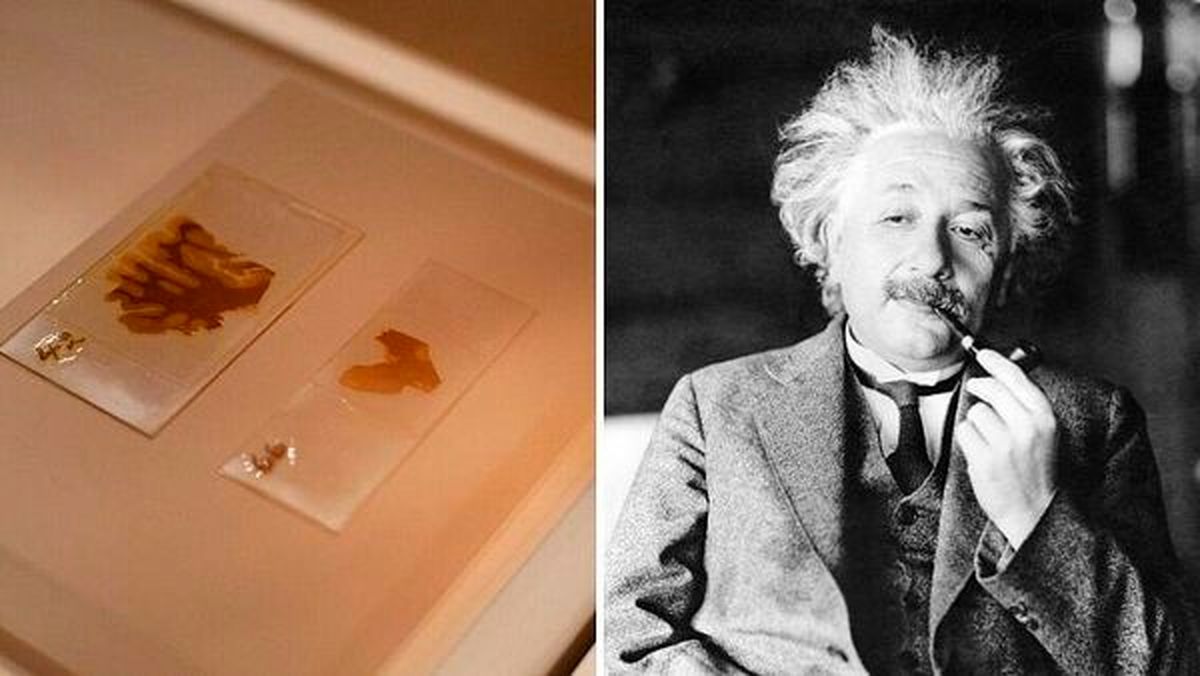 ماجرای دزدی مغز اینشتین توسط یک پزشک