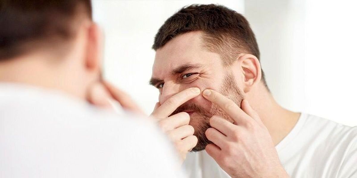 برای درمان جای جوش چه کنیم؟