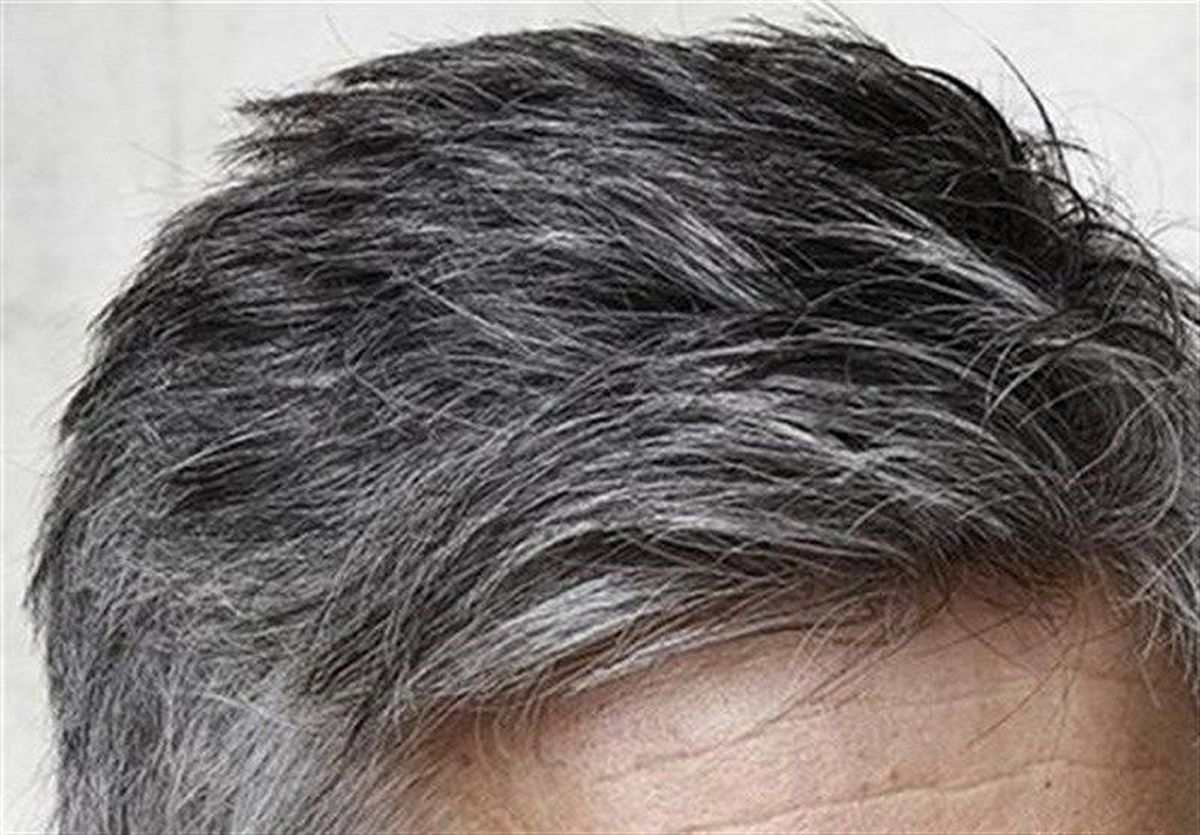 سفید شدن مو قبل از ۴۰ سالگی را جدی بگیرید!