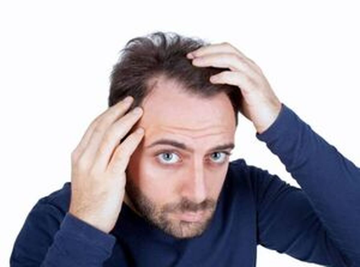 چرا موی سر چرب میشود؟