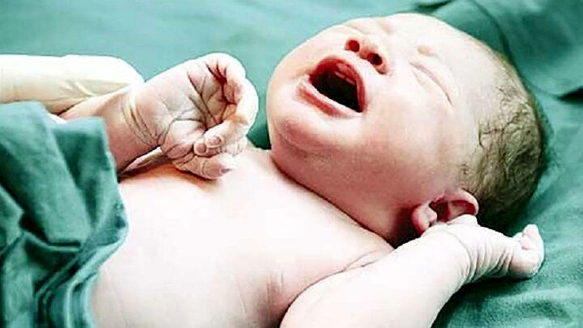 این نوزاد تازه متولد شده 4 انگشت از انسانها بیشتر دارد!+تصاویر