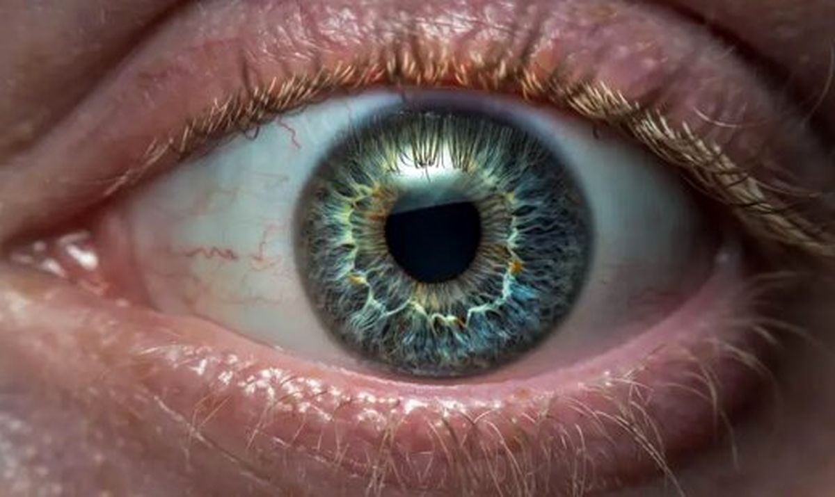 فشار چشم چگونه به وجود میآید؟