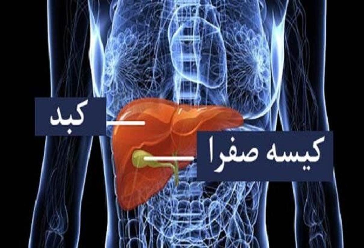 بهترین راه تشخیص سنگ کیسه صفرا چیست؟