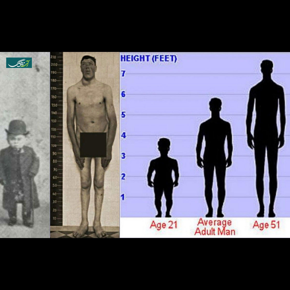 تنها مرد تاریخ که هم کوتوله بود و هم غول! +عکس