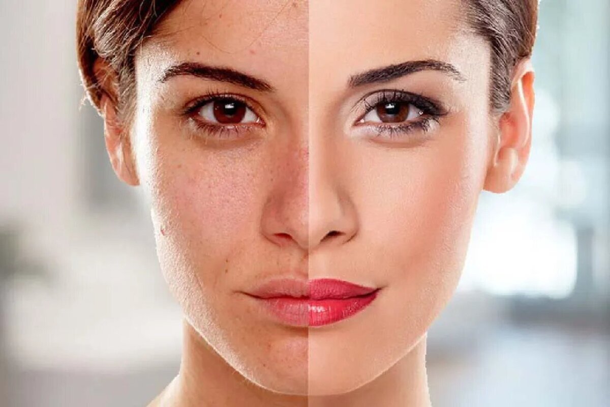 ۱۰ روش شگفت انگیز برای سفیدی پوست