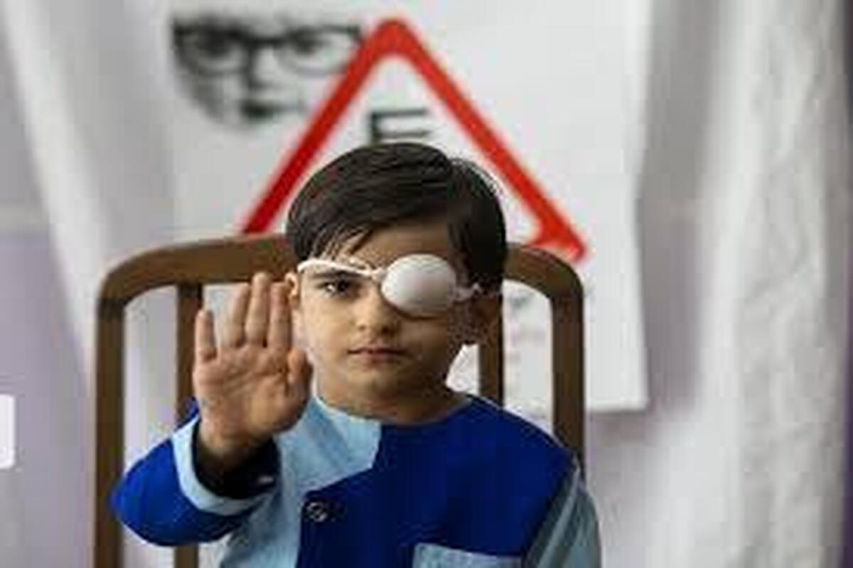 میزان شیوع تنبلی چشم در کشور به ۱.۵ درصد کاهش یافته است