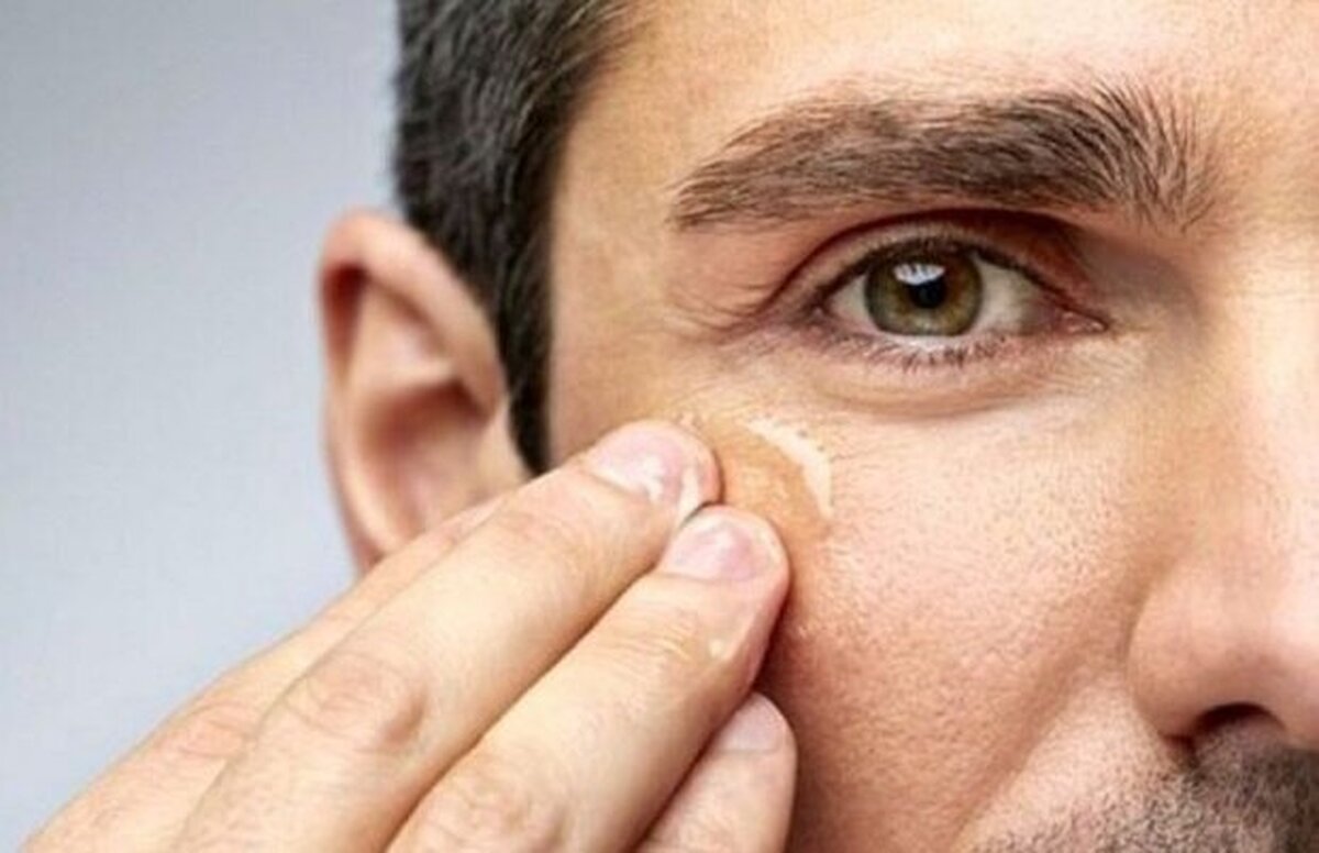 آفتاب، عامل اصلی این بیماری کشنده در پوست است مراقب زخم های که خوب نمی‌شوند باشید