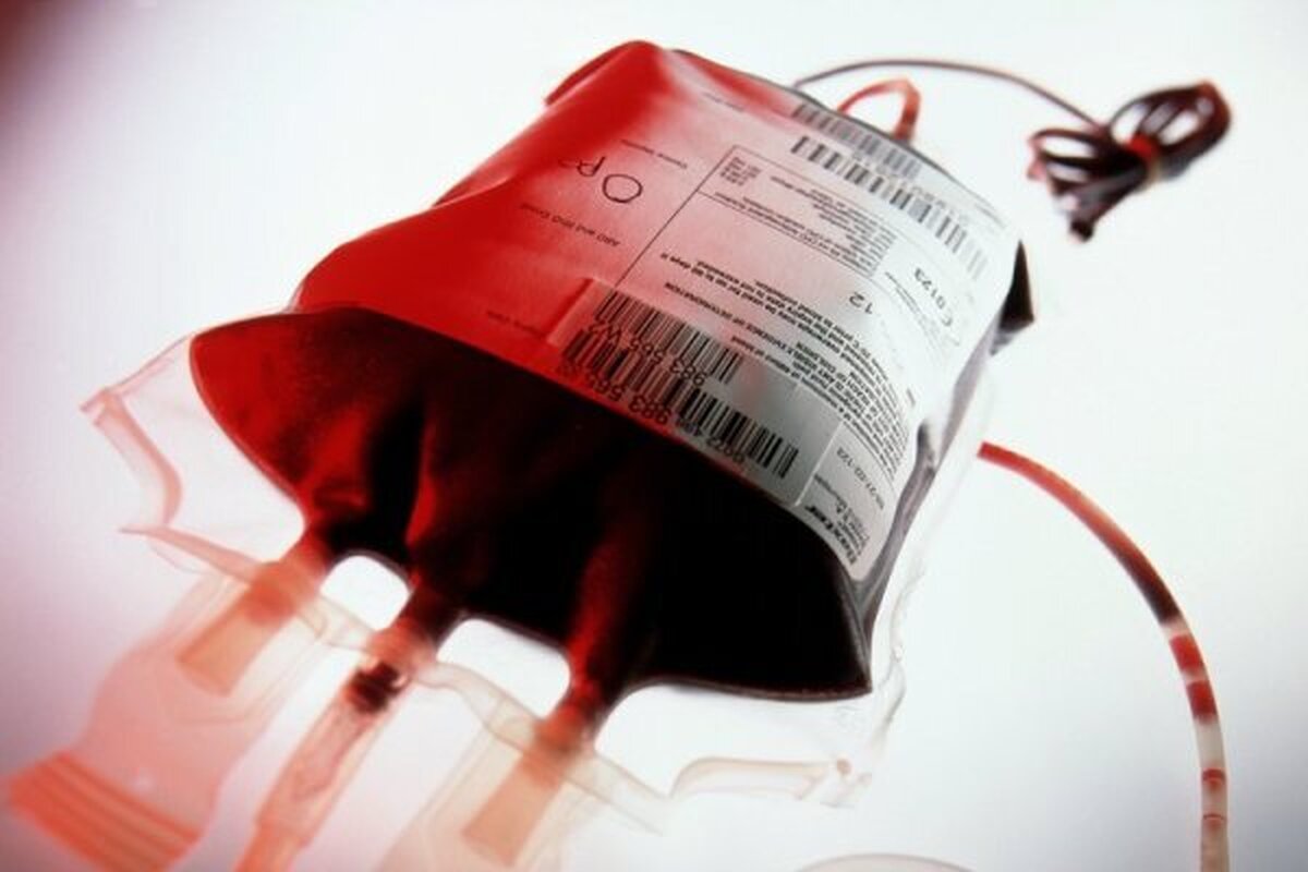 «پلاکت»؛ فرآورده‌ای با عمر کم و فواید زیاد