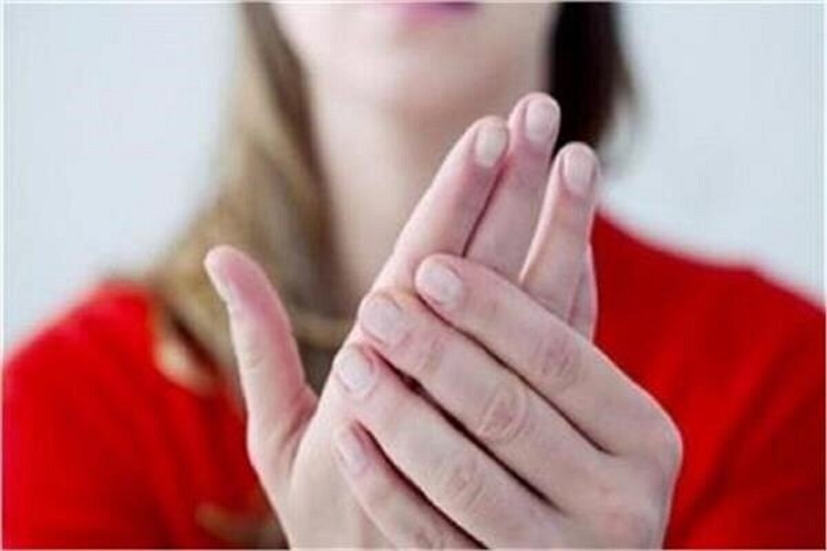 رنگ زرد ناخن نشانه چیست؟