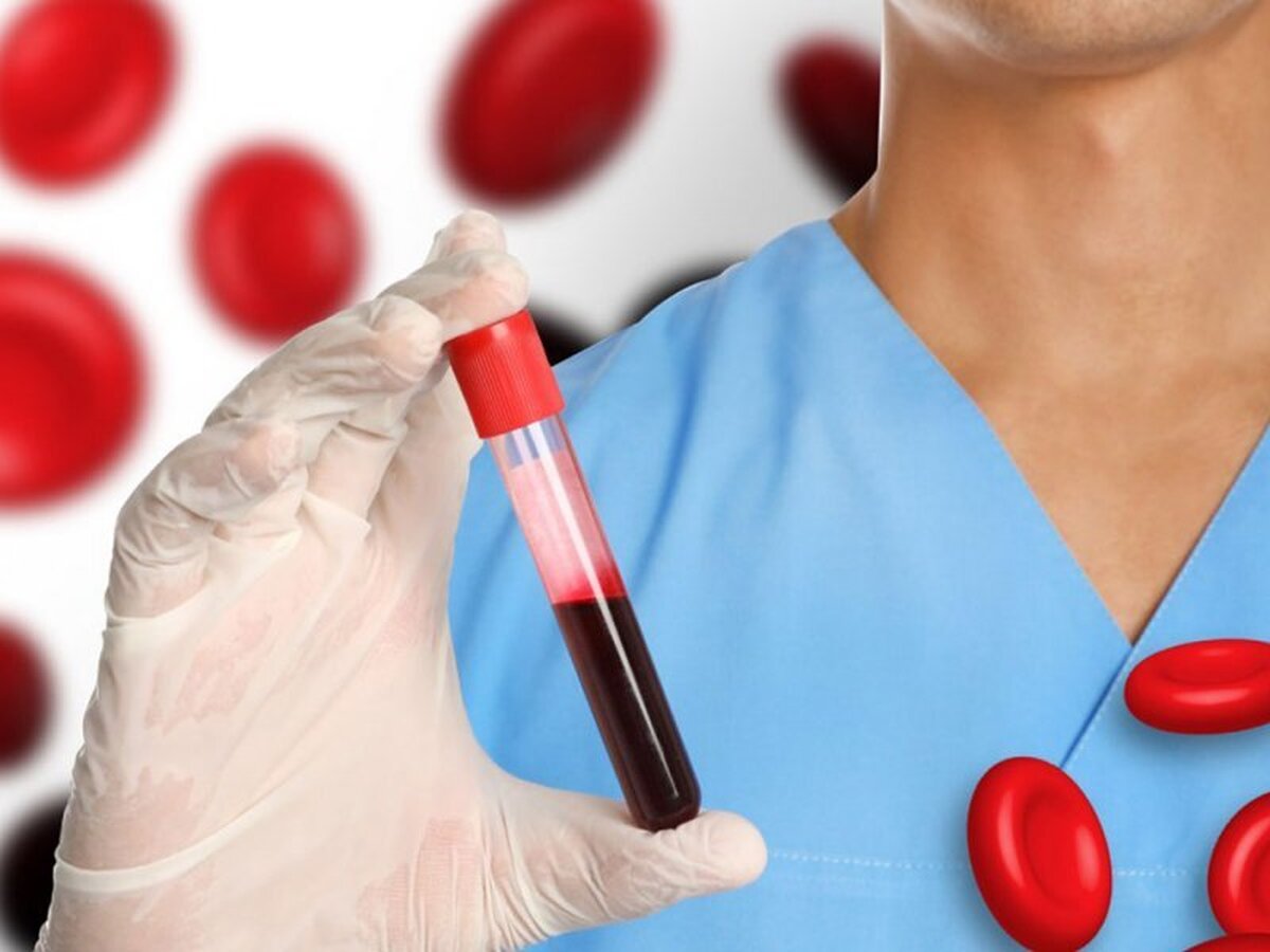 از هر ۱۰ زن، ۳ نفر کم‌خونی دارند