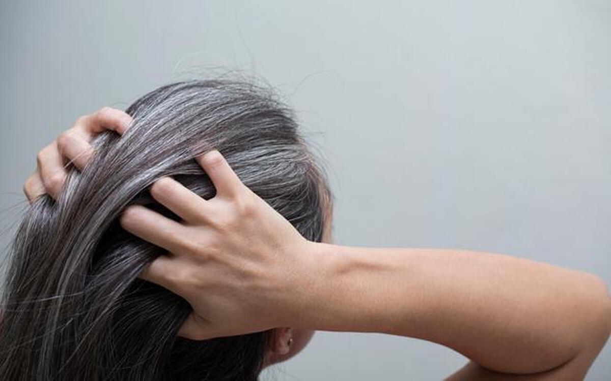 یافتهای جدید درباره سفید شدن مو