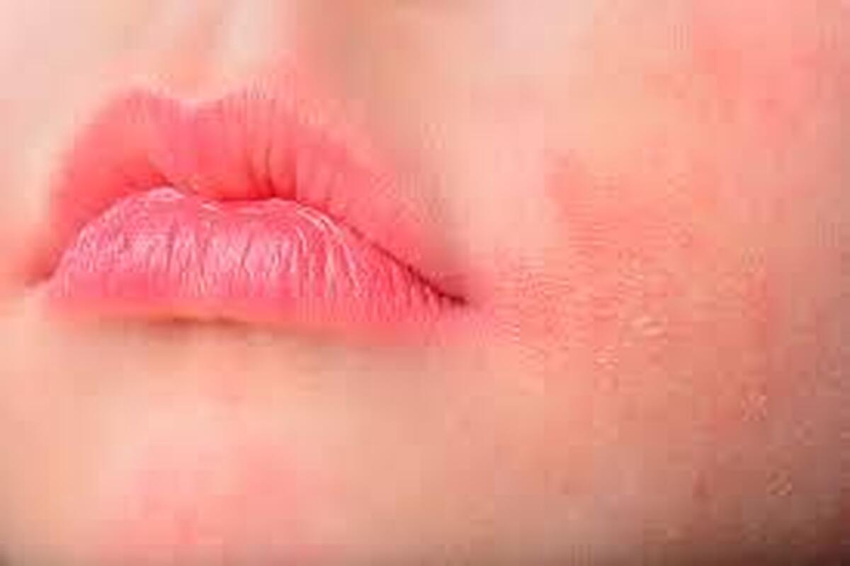 سوزش و قرمزی که اطراف دهان کودکان برای چیست؟
